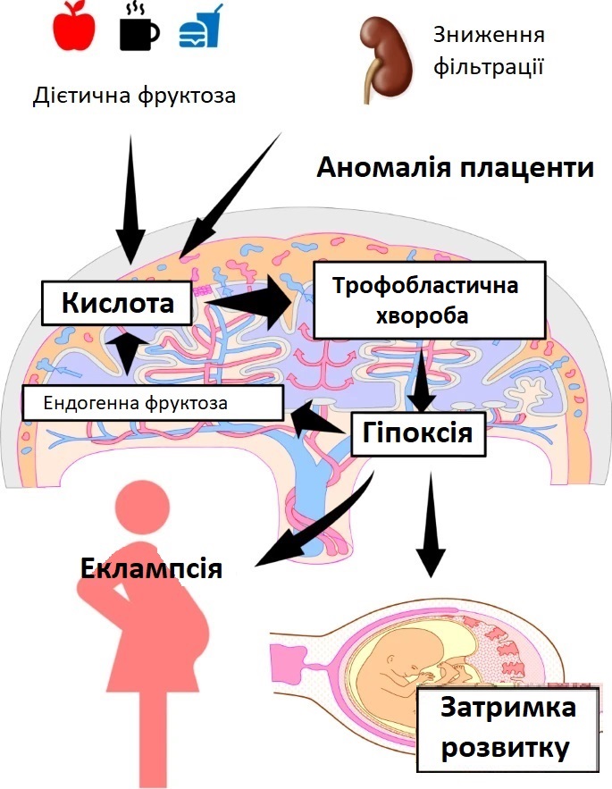 Солі в сечі у вагітної