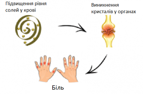 Що таке сечокислий діатез