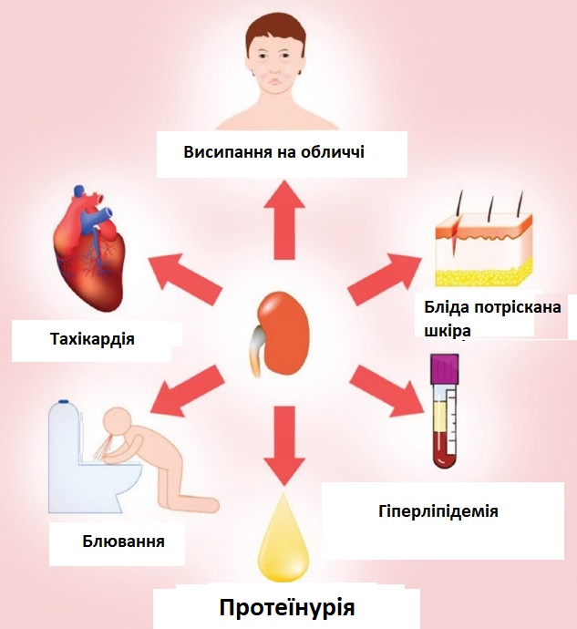 Чи небезпечно якщо у сечі білок